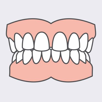 gapped teeth